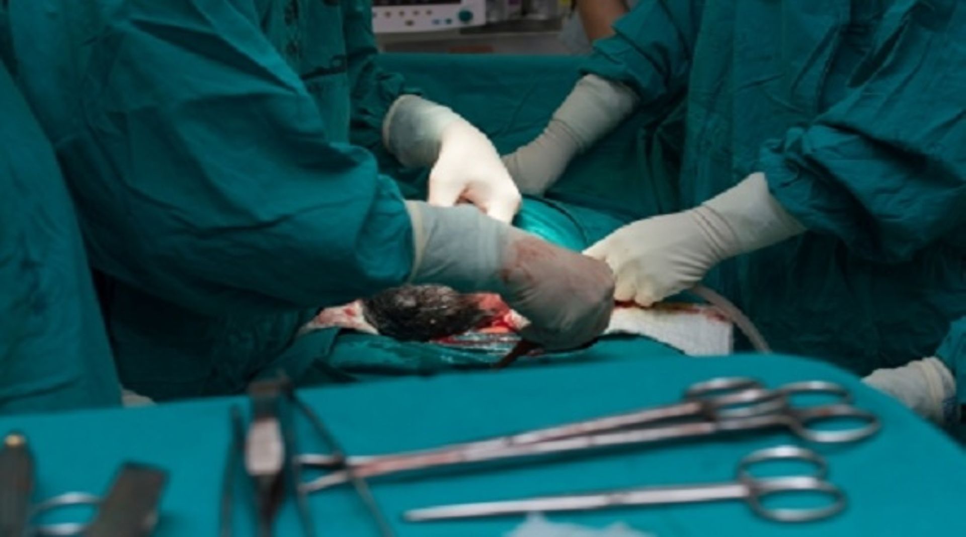 India: Ascent, OrbiMed plan to sell stake in Kerala Institute of Medical Sciences hospital chain