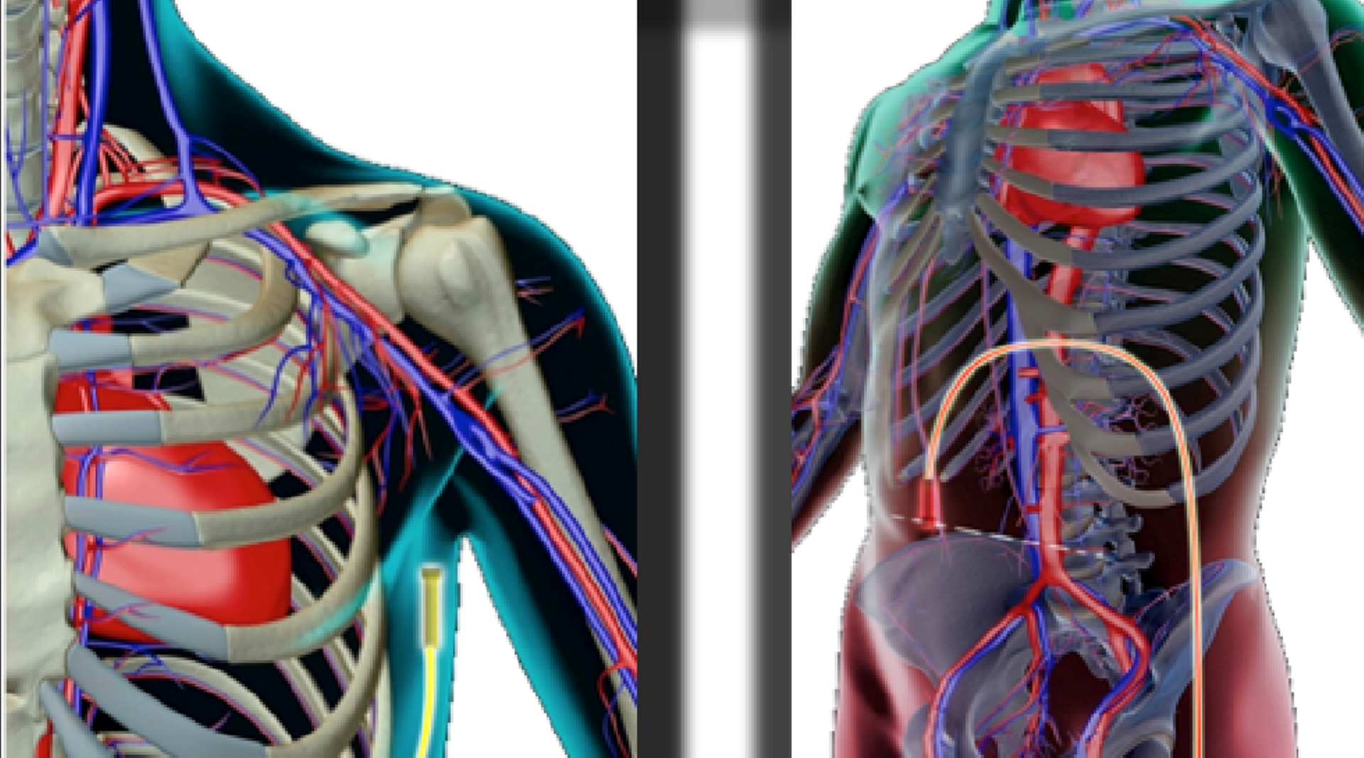 China: Hebron, BioPromin form $50m medical devices JV