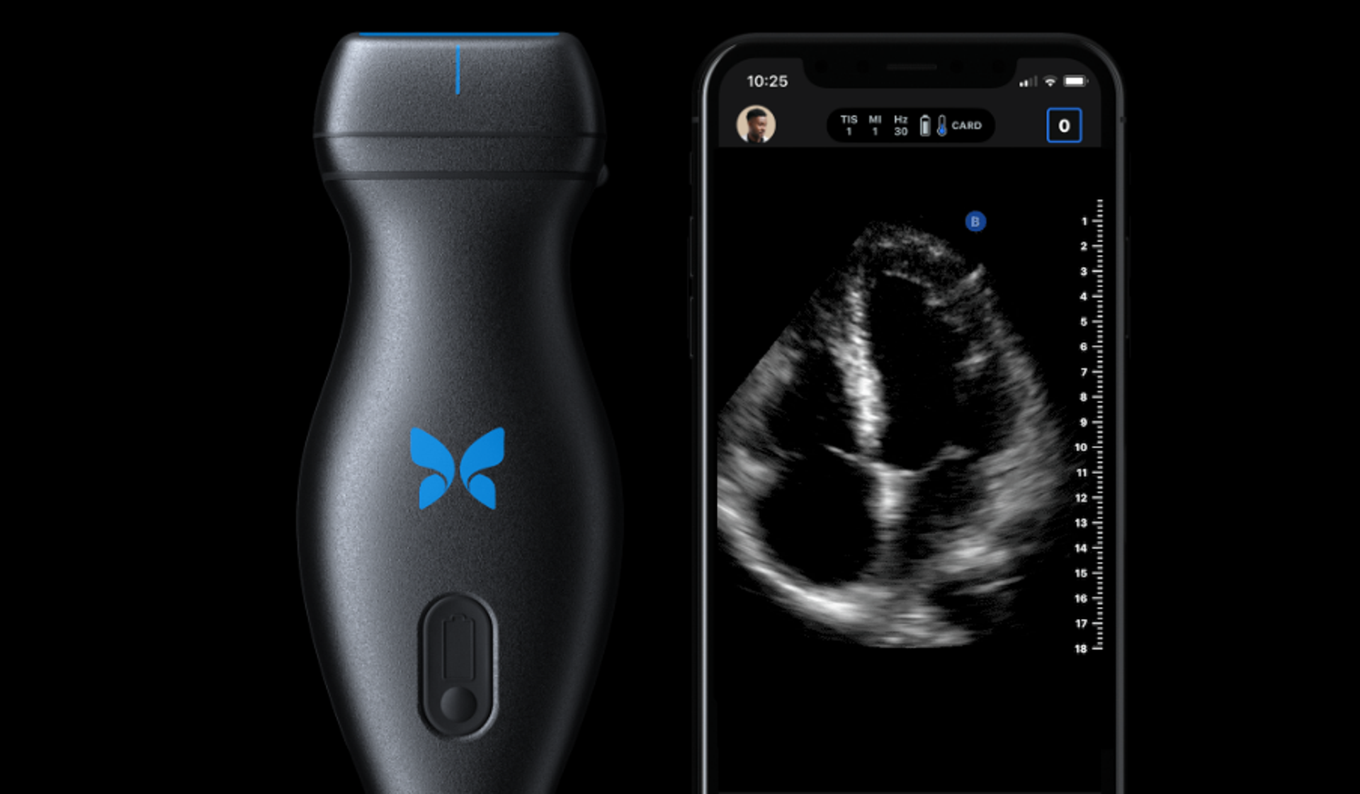 China Digest: GGV joins $30m round for Nozomi; Fosun backs $250m investment in Butterfly