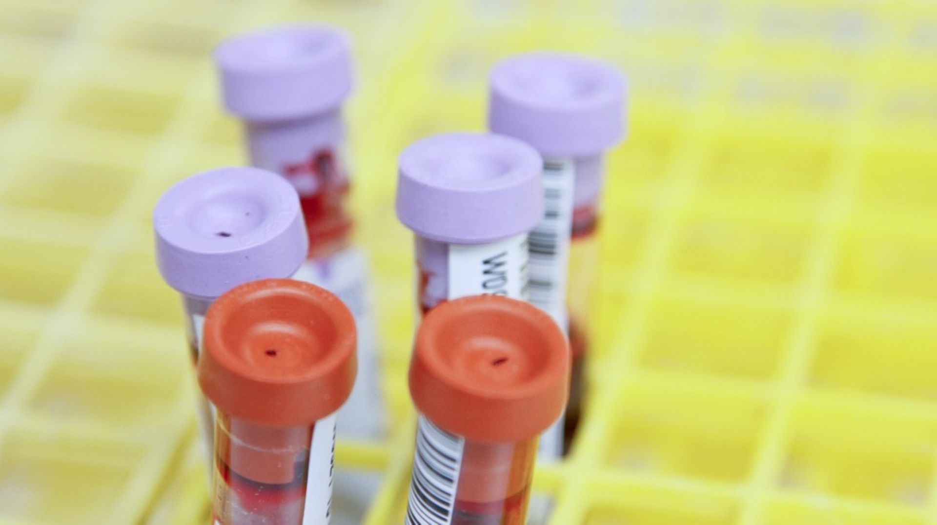 Indian diagnostics chain Krsnaa files papers to raise funds via IPO