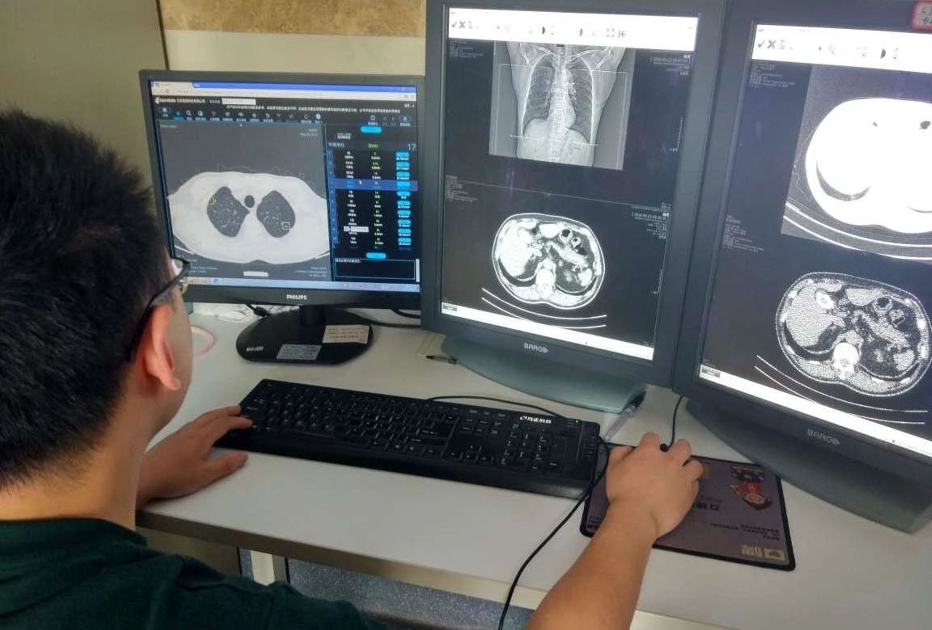 Qiming's Springhill backs AI medical imaging startup Infervision's $139m Series D round